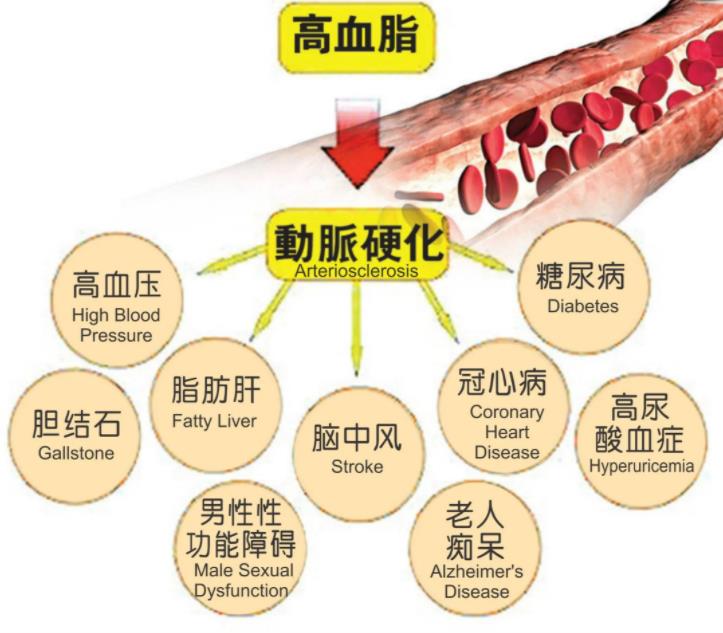 高血脂的危害